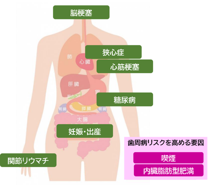 全身疾患のイラスト