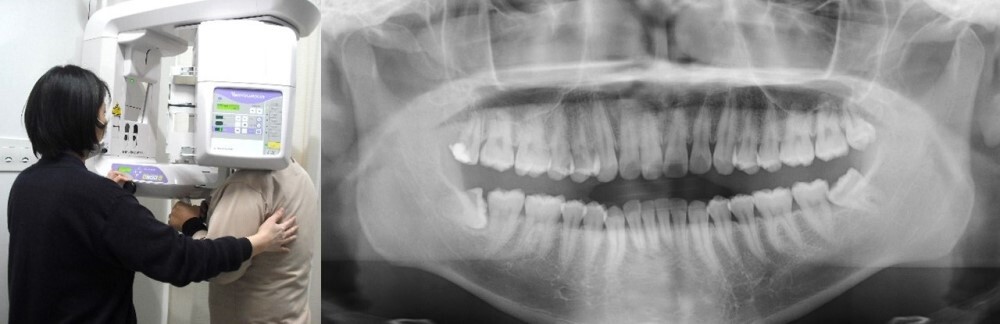 写真：歯科パノラマ撮影