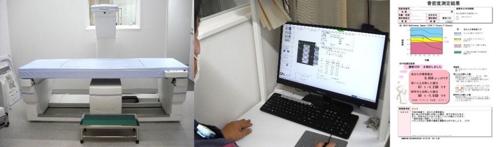 写真：骨密度測定