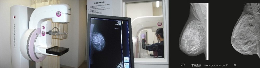 写真：マンモグラフィ検査
