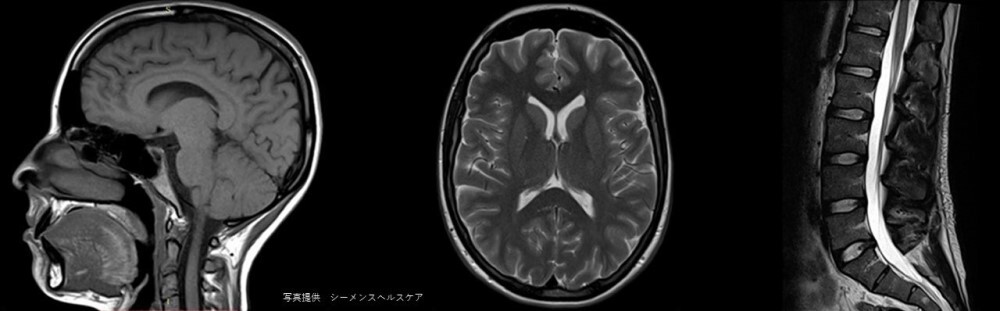 写真：MRI2