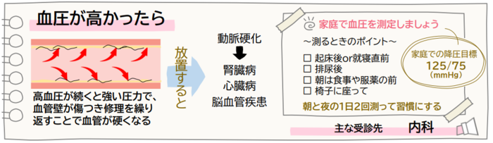 高血圧が続くと強い圧力で、血管壁が傷つき、修理を繰り返すことで血管が硬くなり動脈硬化へと進行します。主な受診先は内科です。