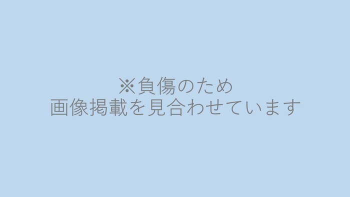 負傷のため画像掲載を見合わせています