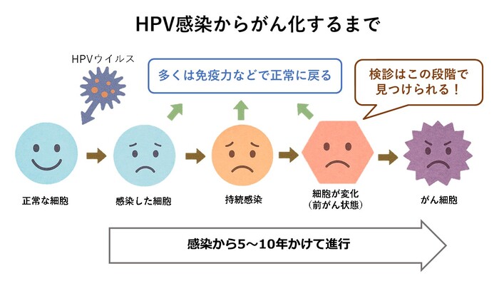 HPVからがん化するまで